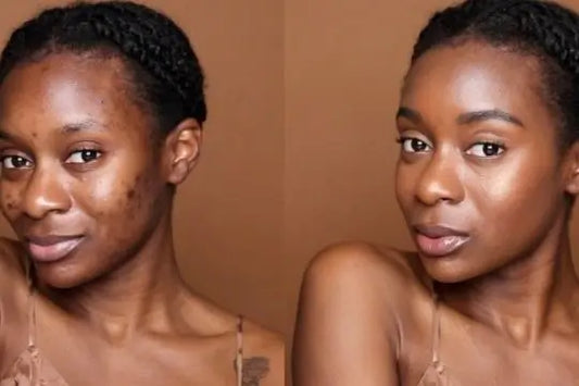 All About Blemiviv Skincare: